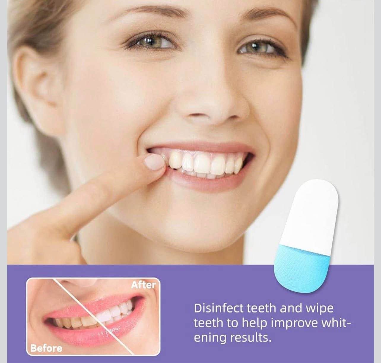 Condition photo showing New/Like New for Teeth whitening kit 