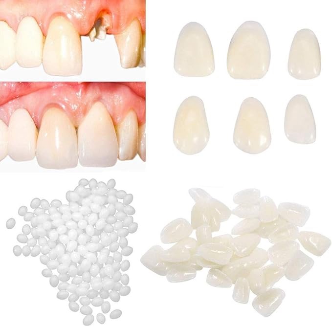 Tooth Repair kit for Filling The Missing Broken Tooth and Gaps-Moldable Fake Teeth and Thermal Beads Replacement Kit