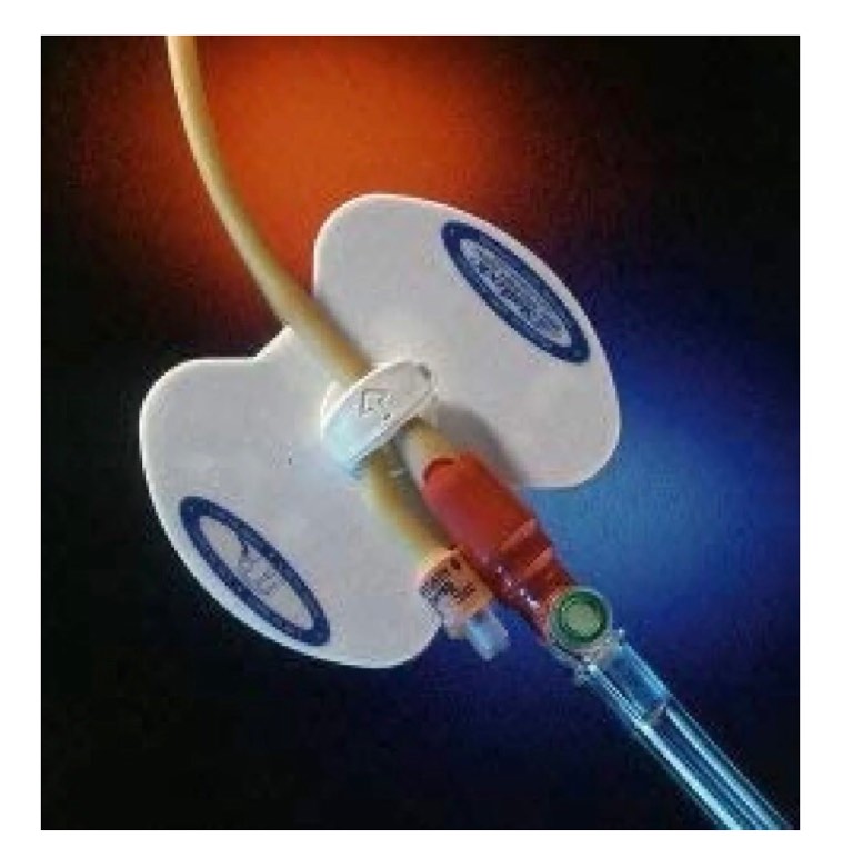 Statlock Stabilization Device FOL0101 - Sold by: Pack of One