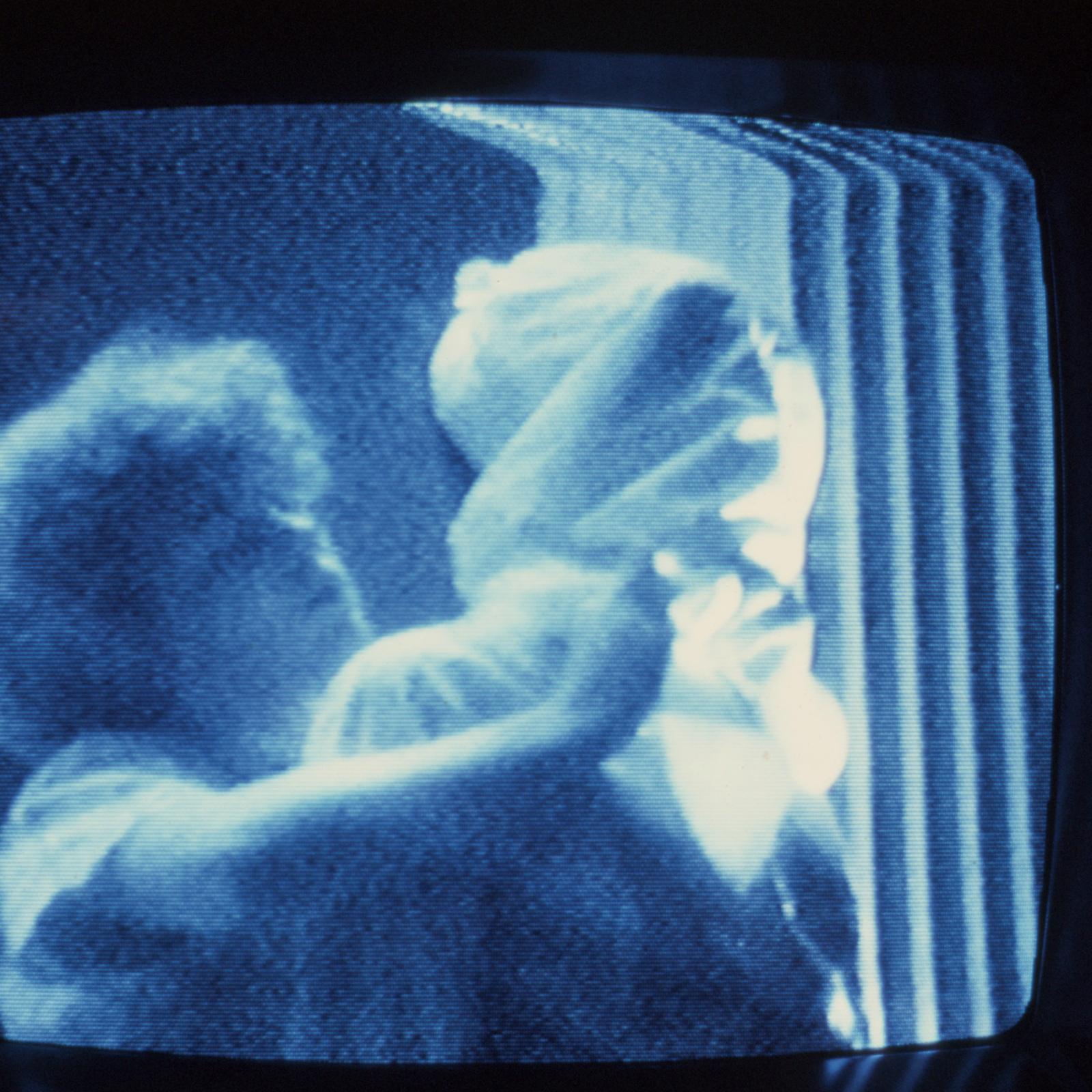 An Evening of Performance Pieces, First Aid, 1979, Memphis, Memphis College of Art, multimedia performance, video still, photo slide 02