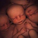 La alimentacion en el embarazo multiple