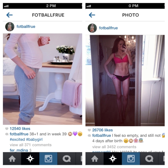 Embarazo y postparto