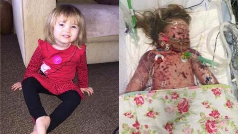 La imagen de Faye Burdett conmovió al Reino Unido