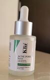 Akash V. review photo