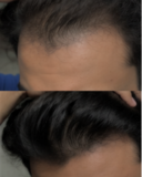 Yash Thakur review photo