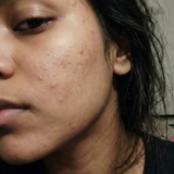 Genesis P. review photo
