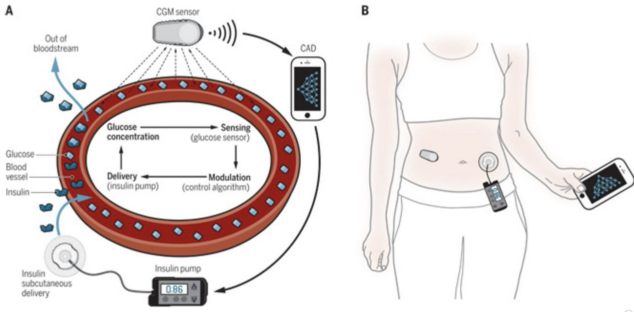 Brabuster System
