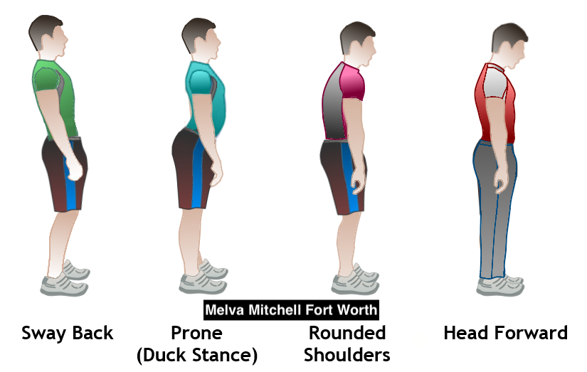 Melva Mitchell Fort Worth Bad Posture