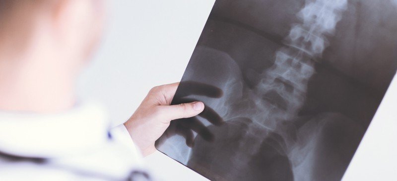 Melva Mitchell Gray Spinal Health