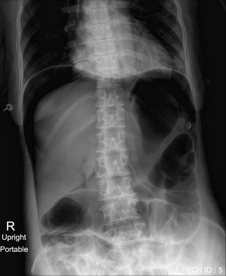 Abdomen Case 7