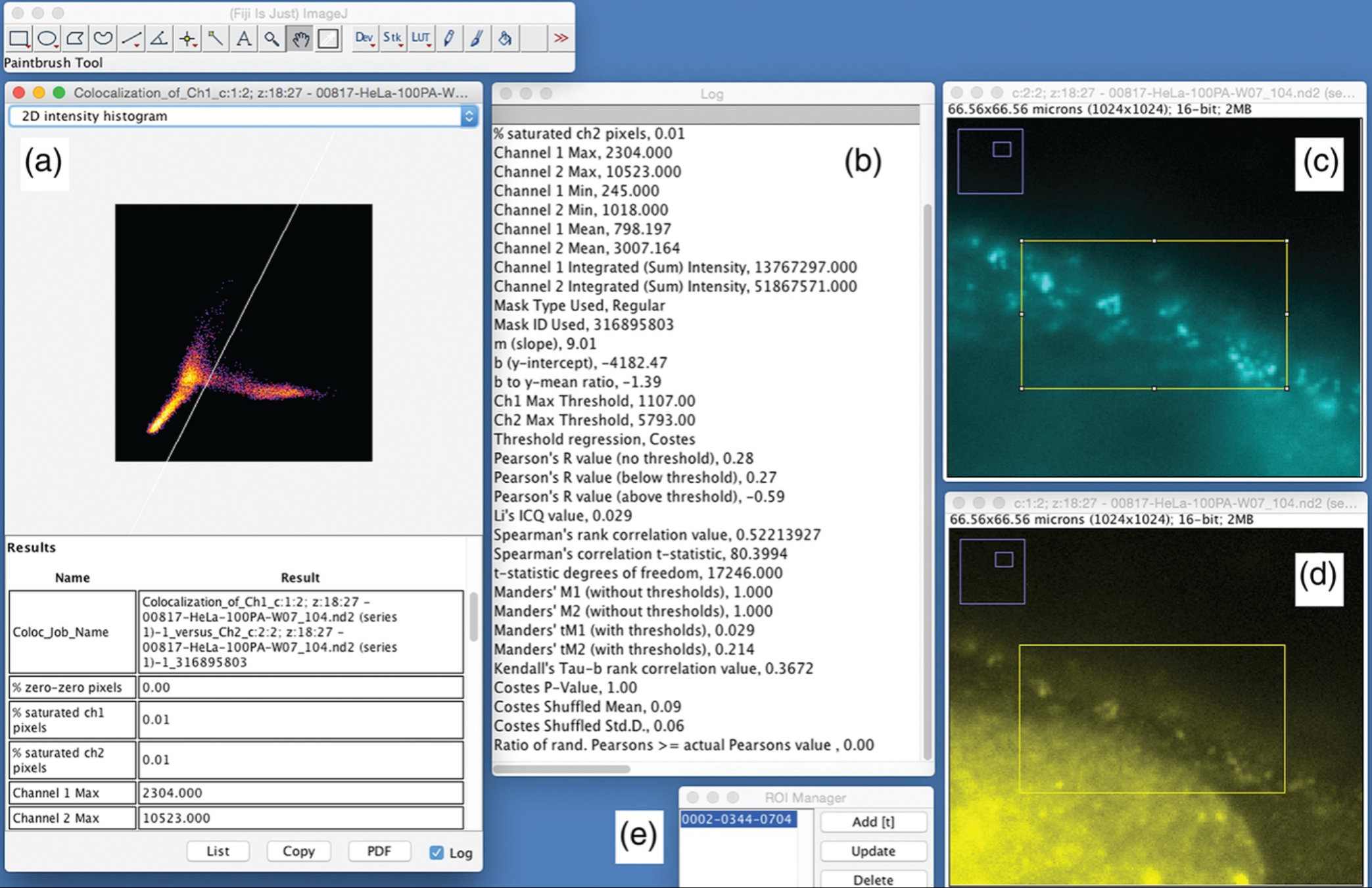 Fiji is just ImageJ. Coloc2 plug-in.