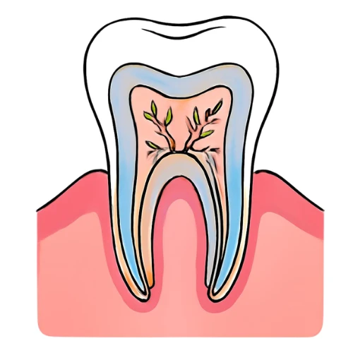 What is a Root Canal?