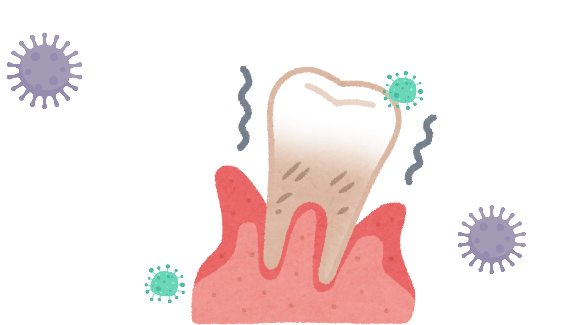 What is Gum Disease?