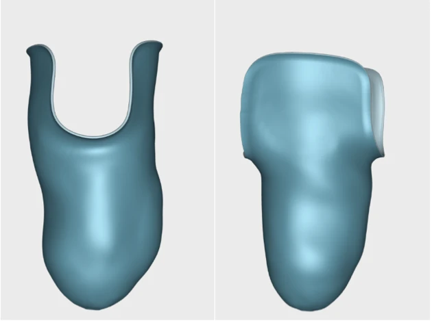 3D printed prosthetic components