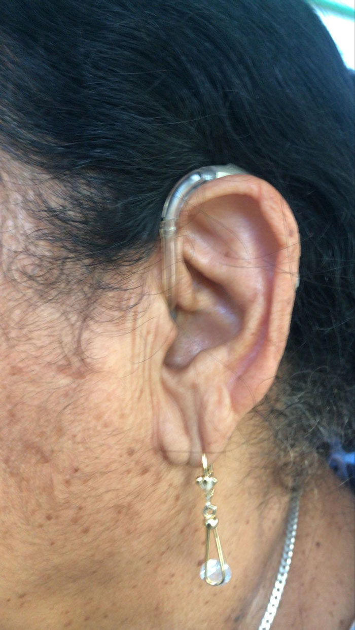 hearing aid recipient 6