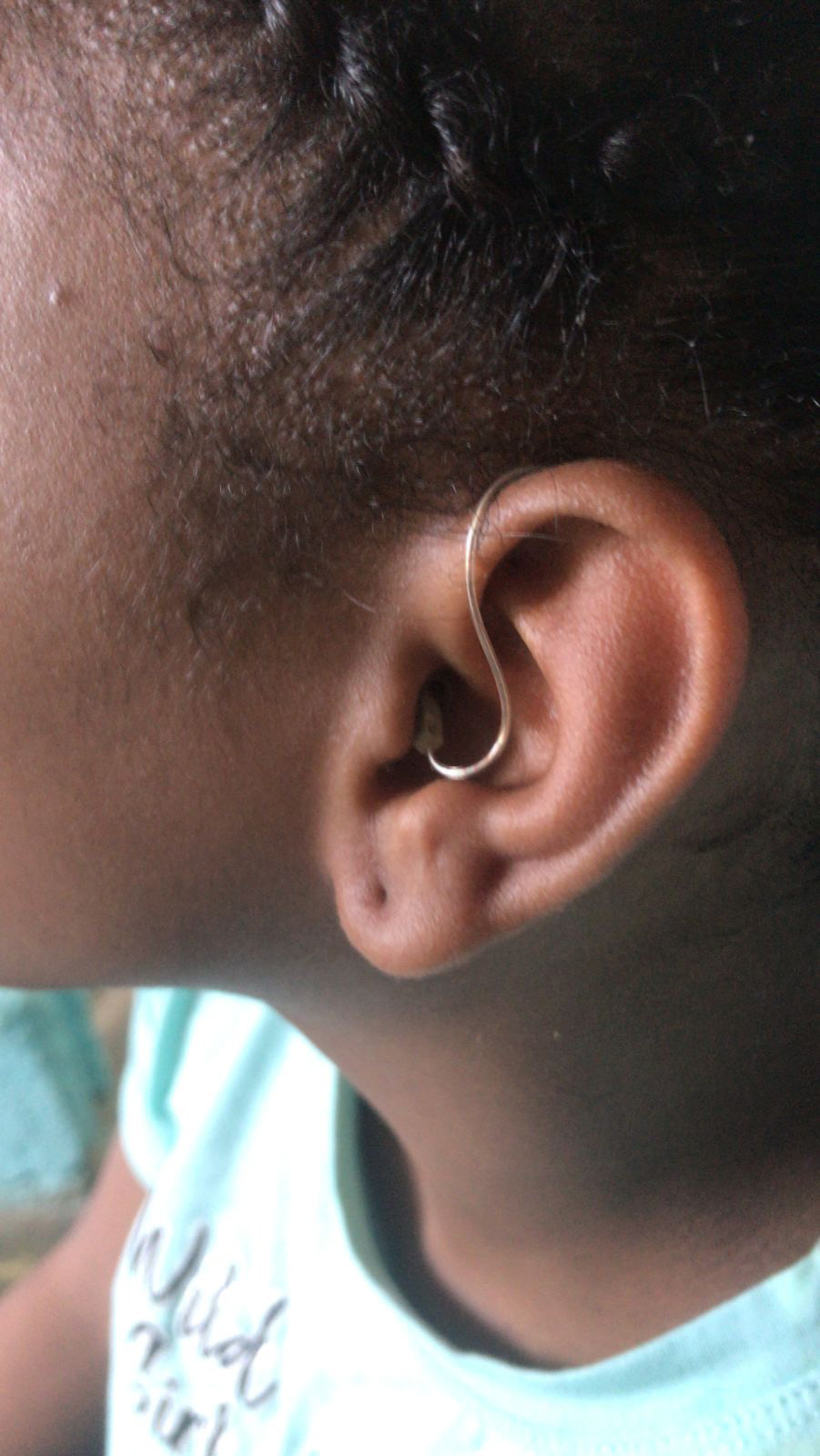 hearing aid recipient 4