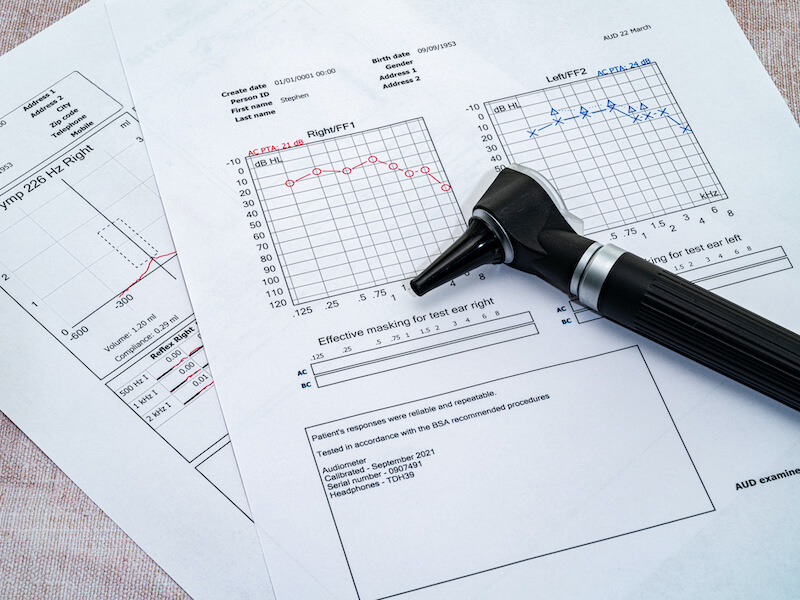 hearing test results and hearing instrument device on paper