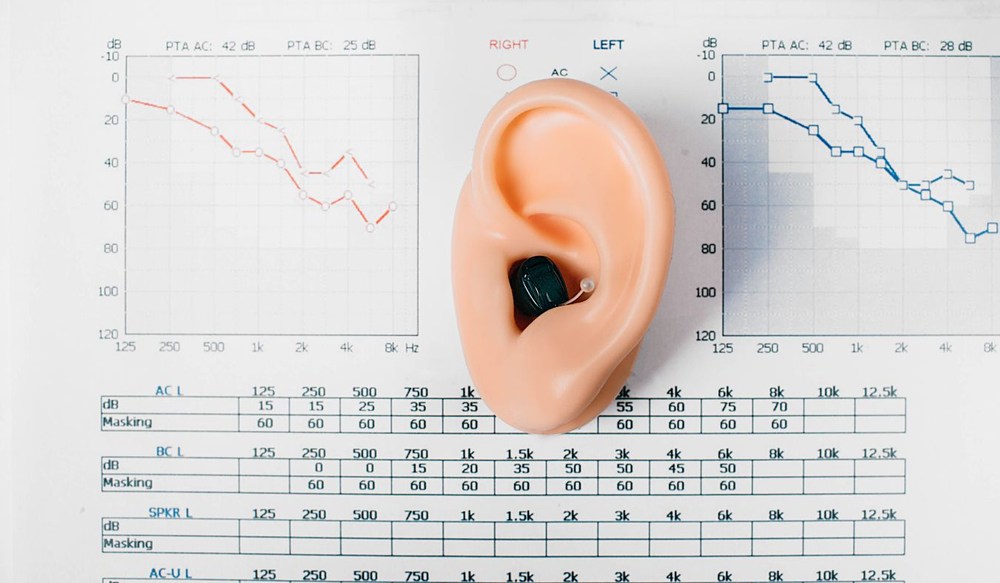 hearing aid in model with audiogram