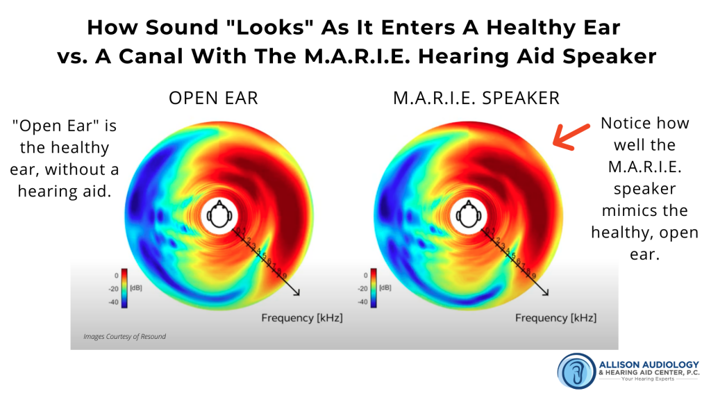 How Sound Looks in a Healthy Ear a diagram of how sound appears on a frequency graph in a healthy ear vs a a M.A.R.I.E. hearing aid speaker