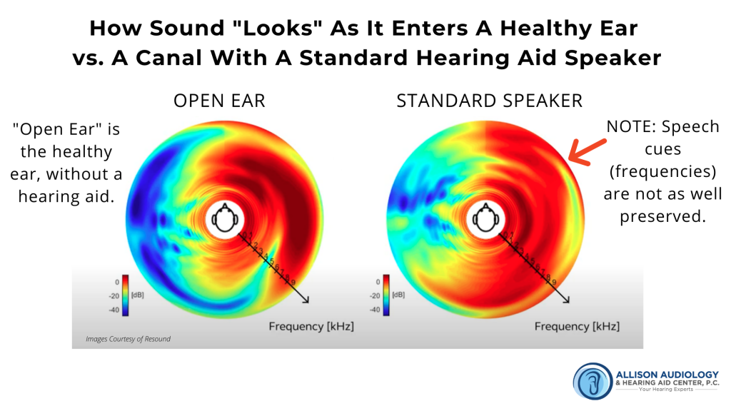 2nd Image of Sound in Healthy Ear vs Standard Speaker B Roll