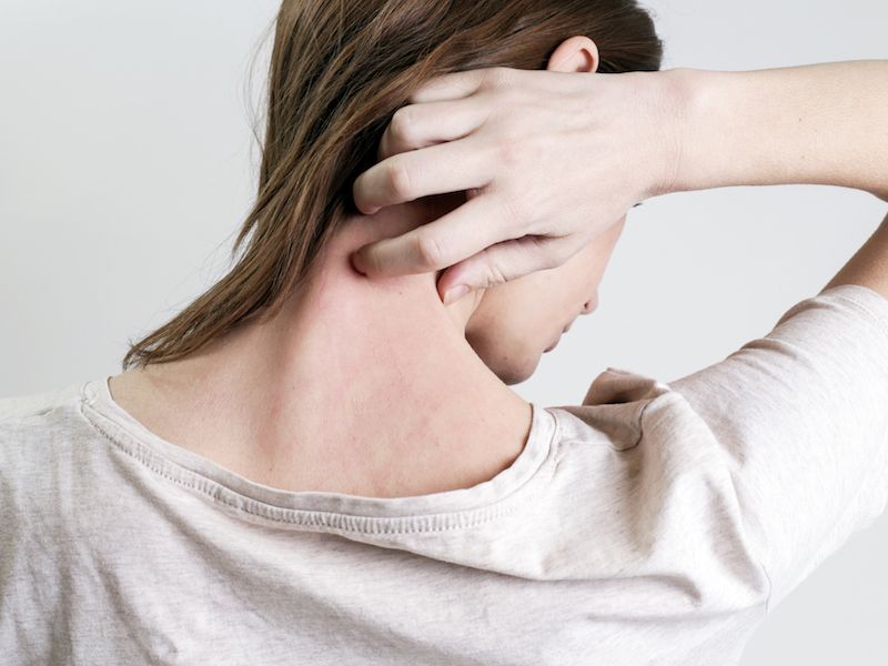 woman scratching her neck due to psoriasis
