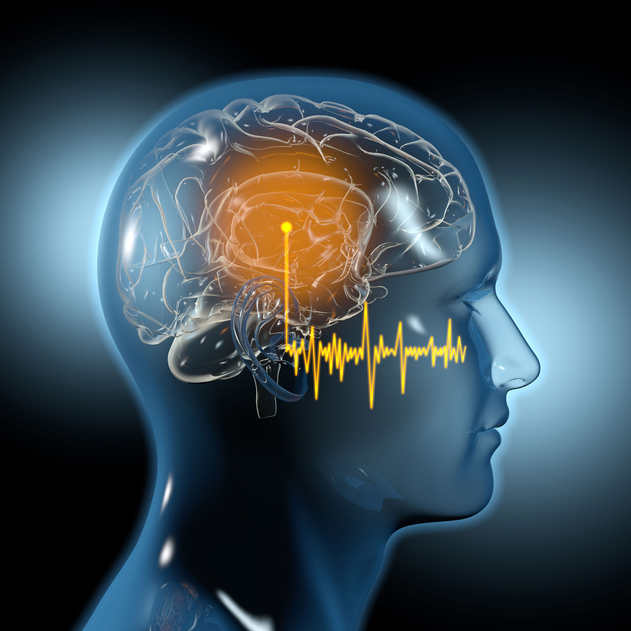tinnitus affecting brain model