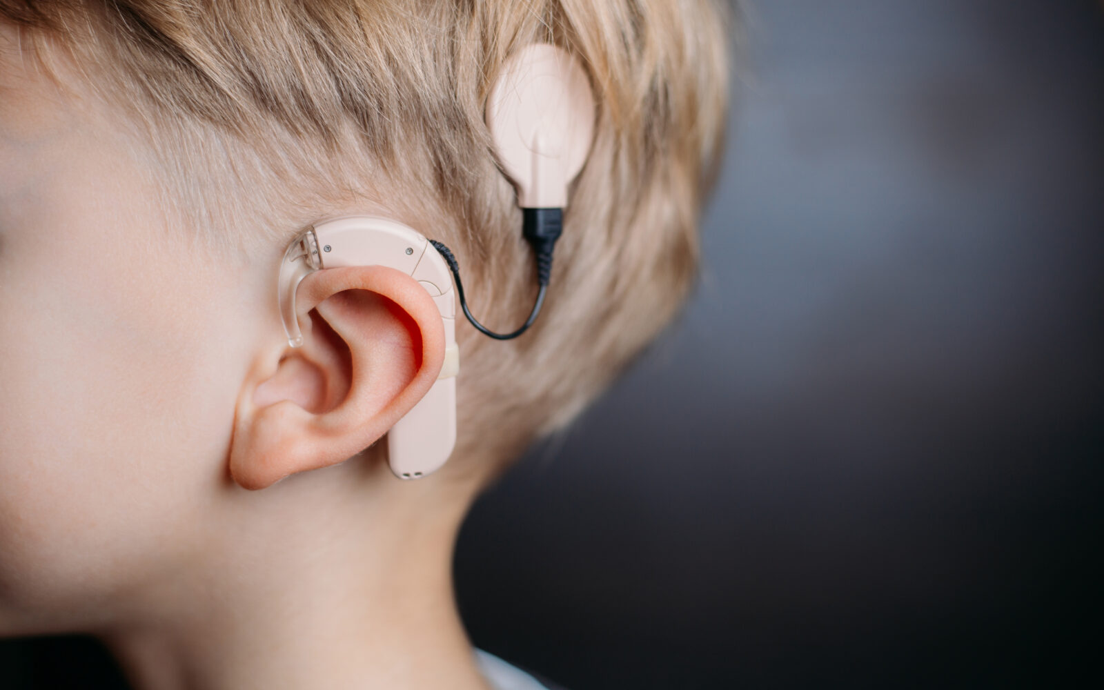 cochlear implant on the boy’s head hearing aid copy space