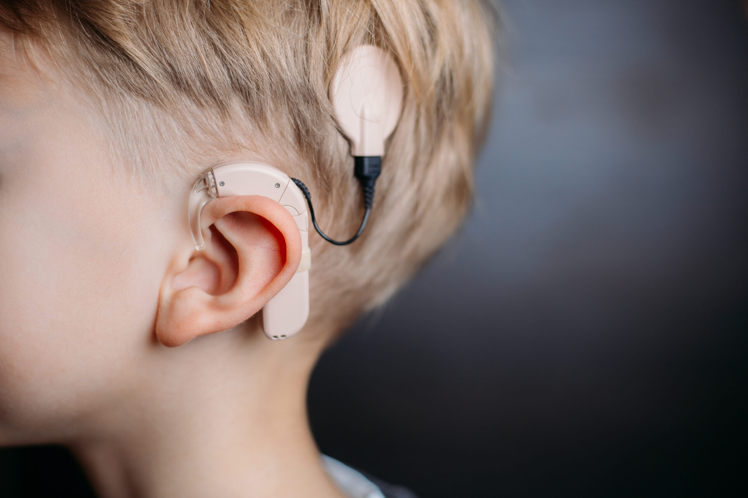 cochlear implant on the boy’s head hearing aid copy space