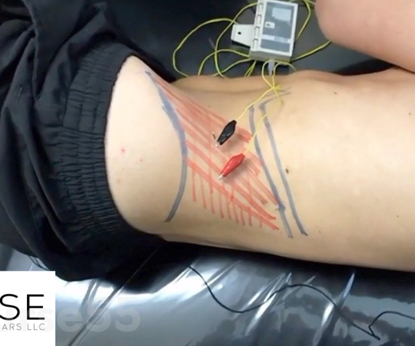 chronic-low-back-pain-assessment-treatment-by-anthony-lombardi-free-download