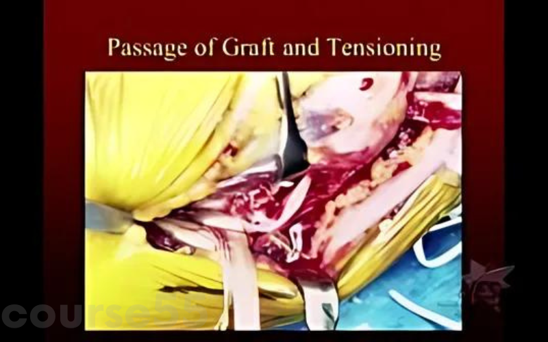 wilk-pti-online-recognition-treatment-of-ucl-injuries-in-athletes-by-kevin-wilk-free-download