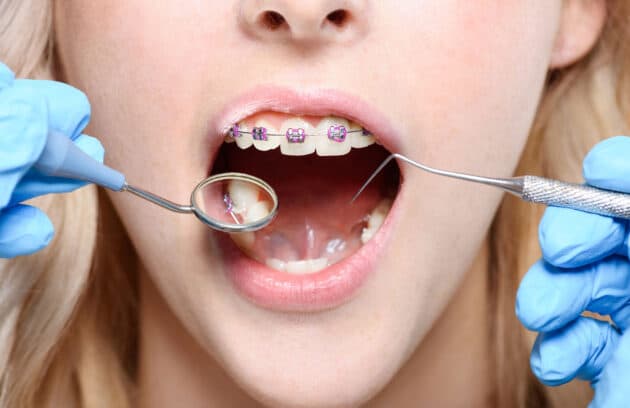 Orthodontic Evaluation for my child