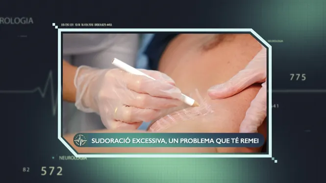 HIPERHIDROSI, SUDORACIÓ EXTREMA