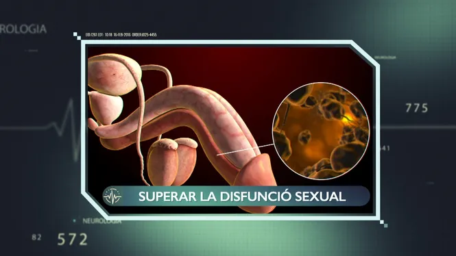 COM RESOLDRE LA DISFUNCIÓ SEXUAL 