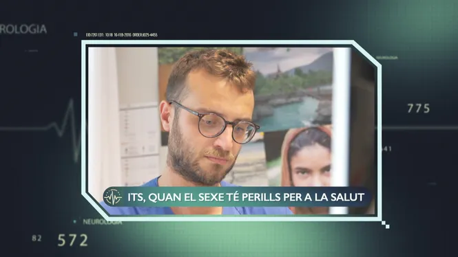 Malalties sexuals
