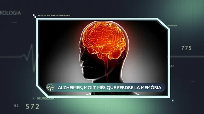ALZHEIMER, MOLT MÉS QUE PERDRE LA MEMÒRIA