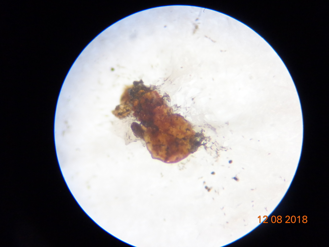 2.DSC08339_Adult female white mango scale (Aulacaspis tubercularis) Newstaed White mango scale, Aulacaspis tubercularis (Hemiptera: Diaspididae) Newstaed under laboratory condition tested for efficacy of entomopathoge control. Fungi blastospore started to grow on the cadaver. Aulacaspis tubercularis (Hemiptera: Diaspididae) Newstaed batch II