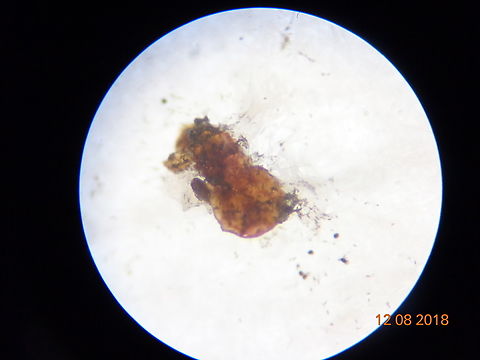 2.DSC08339_Adult female white mango scale (Aulacaspis tubercularis) Newstaed White mango scale, Aulacaspis tubercularis (Hemiptera: Diaspididae) Newstaed under laboratory condition tested for efficacy of entomopathoge control. Fungi blastospore started to grow on the cadaver. Aulacaspis tubercularis (Hemiptera: Diaspididae) Newstaed batch II