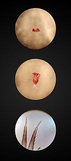 Dicyrtoma dorsosignata (specimen), Netherlands Last week, I accidentally documented a springtail species never reported before in the Netherlands:
https://www.jungledragon.com/image/104964/dicyrtoma_dorsosignata_heesch_netherlands.html
The species was identified as Dicyrtoma dorsosignata by Frans Janssens (https://www.collembola.org/). Frans passed on the observation to Matty Berg. Matty is a professor at the Vrije Universiteit Van Amsterdam, and the leading expert on soil fauna and specifically springtails in the Netherlands. In a recent interview, when asked who else is structurally finding, identifying and researching springtails: "It's just me".

Whilst Matty agreed with Frans' species ID based on my photo, he still wanted to formalize it as a new addition to dutch fauna by trying to collect a specimen. As I had no idea that it was a special observation during the photography, I had returned the live specimen to the garden. 

Last Saturday, Matty came to our home, to try and find a fresh specimen. This post discusses results and is written in honor of his work.

One thing I was eager to learn is how he finds and collects specimens. It turns out to be simple, yet innovative and extremely effective. A large white tray is used to catch them, the white being a useful contrast to see the subjects. Method 1 to fill the tray is to heavily shake plants and bushes whilst keeping the tray under it. Method 2 places piles of dry/rotting leafs from the lawn on a filter, and then shaking the filter heavily, so that the subjects fall in the tray beneath.

As I saw the tray filling up, I cringed at how I didn't think of this earlier. We're in an urban garden, in December, yet there's tons of stuff in the tray. Springtails, but also spiders, crickets, net-winged insects, all kinds of stuff I wasn't expecting. The method is so obvious in hindsight, as it is obvious that I'm not an entomologist. The only thing against this method is that it's disruptive, it displaces almost anything living on the plant. This makes sense for the purpose of research, which needs to be effective, yet for photography subject selection I probably would be a bit more selective.

The next part is innovative. Each time a tray was inspected, we'd typically find many springtails, yet only 3-5 globular springtails, which is what the target was. How do you collect such a tiny creature? Here's how:

https://images3.persgroep.net/rcs/jxLctFq3qZQAa1KomxU5uw9JVwk/diocontent/69958945/_crop/0/0/293/298/_fitwidth/763?appId=93a17a8fd81db0de025c8abd1cca1279&quality=0.8

With this self-made air tube, Matty gently sucks at the end of the tube in his mouth. On the other end of the tube is a small compartment, where they get stuck. Simple as it is, it is a very fast and touch-free way to isolate a springtail without damaging it. When the compartment is full, it's placed in a test tube.

Surprisingly, no magnification tools are used at all, not even a magnifying glass. Just from the creature's profile and the way it mildly shines in daylight, Matty has a pretty good idea of what it is. A sign of experience. The above process was repeated for some 90 minutes. Matty was to do actual detailed inspection of the specimens collected back home, using a microscope. One day after his visit, he sent me this:

Orchesella cincta: 13
Orchesella villosa: 1
Pogonognathellus flavesecens: 1
Entomobrya multifasciata: 145
Heteromurus major: 5
Isotomurus maculatus: 2
Sminthurinus elegans: 2
Sminthurinus alpinus : 1
Parisotoma notabilis: 5
Proisotoma minuta: 1
Entomobrya lanuginosa: 1
Dicyrtomina ornata: 132
Dicyrtomina saundersi: 43
Dicyrtoma fusca: 11
Dicyrtoma dorsosignata: 1

This is next level trolling. So, out of 364 springtails collected, just bloody ONE is Dicyrtoma dorsosignata. And it's at the end of the list. What a cliffhanger. 

These microscope photos are by Matty, published with his permission. Note that I increased the contrast. They show different angles of the single Dicyrtoma dorsosignata specimen. Whilst I don't yet understand the key system, apparently the closeup of the furca shows characteristics unique to Dicyrtoma dorsosignata.

And that closes this chapter. It's been fun and educational, gratitude to Frans, Matty and Arp for their help, education and excitement.  Dicyrtoma dorsosignata