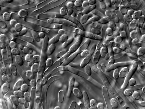 Yarrowia lipolytica This was a yeast I used a lot less in my studies. it is very interesting because it can grow using aerobic metabolism using a variety of carbon sources that other yeast cannot metabolize and they have the ability to store lipids. Geotagged,United States,Yarrowia lipolytica