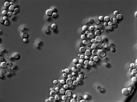 Debaryomyces hansenii I have not worked much with this one. Morphologically it looks like most other popular yeast but it has the special characteristic to be a highly salt-tolerant yeast and you can find it for example in certain cheeses.
For more on the abilities of this and the other yeasts I am showing feel free to browse this link:
http://www.globalsciencebooks.info/Online/GSBOnline/images/0706/DBPBMB_1(1)/DBPBMB_1(1)40-62o.pdf Debariomyces hansenii,Debaryomyces hansenii,Geotagged,United States