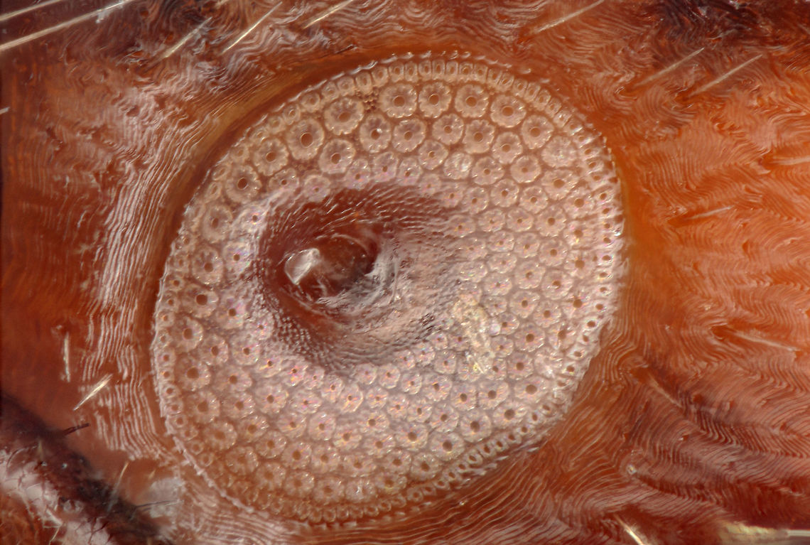 Spiracle of Ixodes scapularis (Deer Tick) 100x photograph of Deer tick spiracle Geotagged,Ixodes scapularis,Spiracle of Ixodes scapularis (Deer Tick),United States