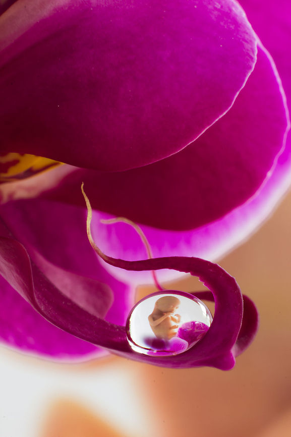 An Ode to Life Itself If only it would be this simple<br />
It&#039;d shed a light in many a darkness.<br />
<br />
So an Ode to Life Itself. And me in an Artistic Mood:)<br />
This one&#039;s a personal one, as having a lovely child is not a right, nor a fact or matter of statistics; sometimes nature is hard in that aspect. If you are lucky enough it is a present of the dearest kind. Cherish it, always.  Canon  EF12mm II,Cooktown Orchid,Geotagged,The Netherlands,macro,orchid,soligor 12mm