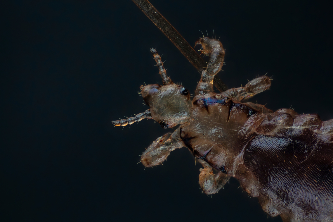 A human head louse  Head louse,Pediculus humanus capitis