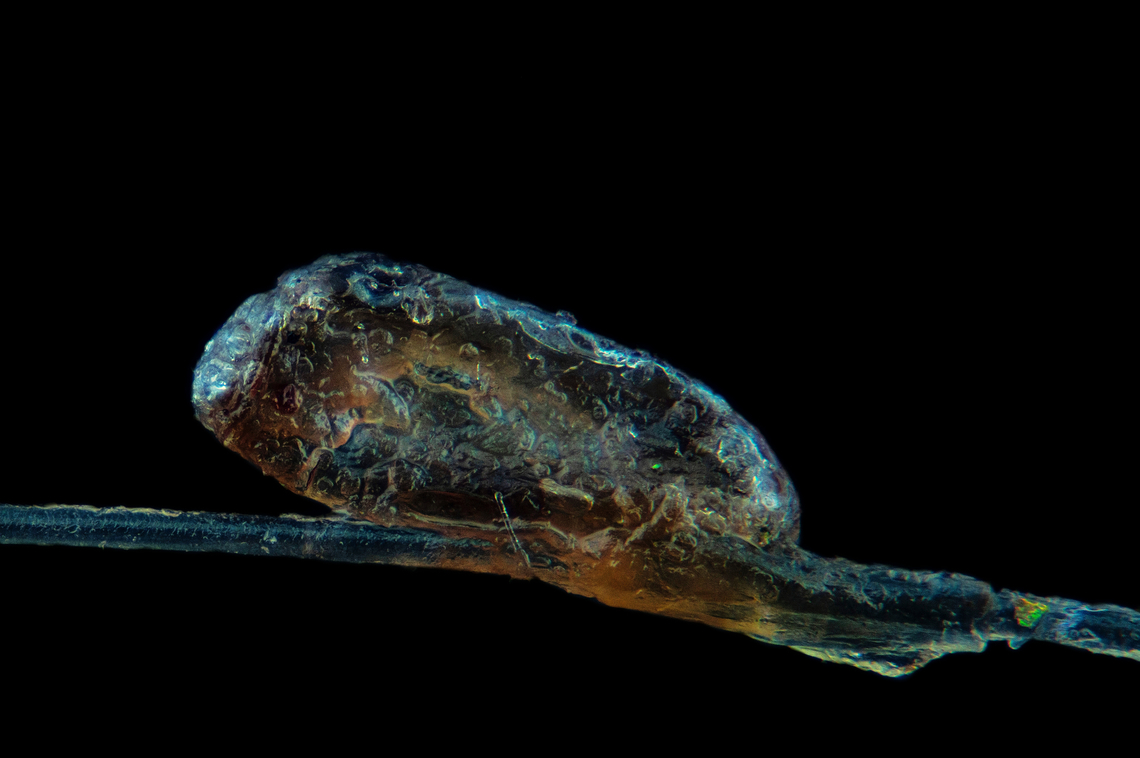 A head louse egg