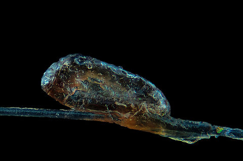 A head louse egg