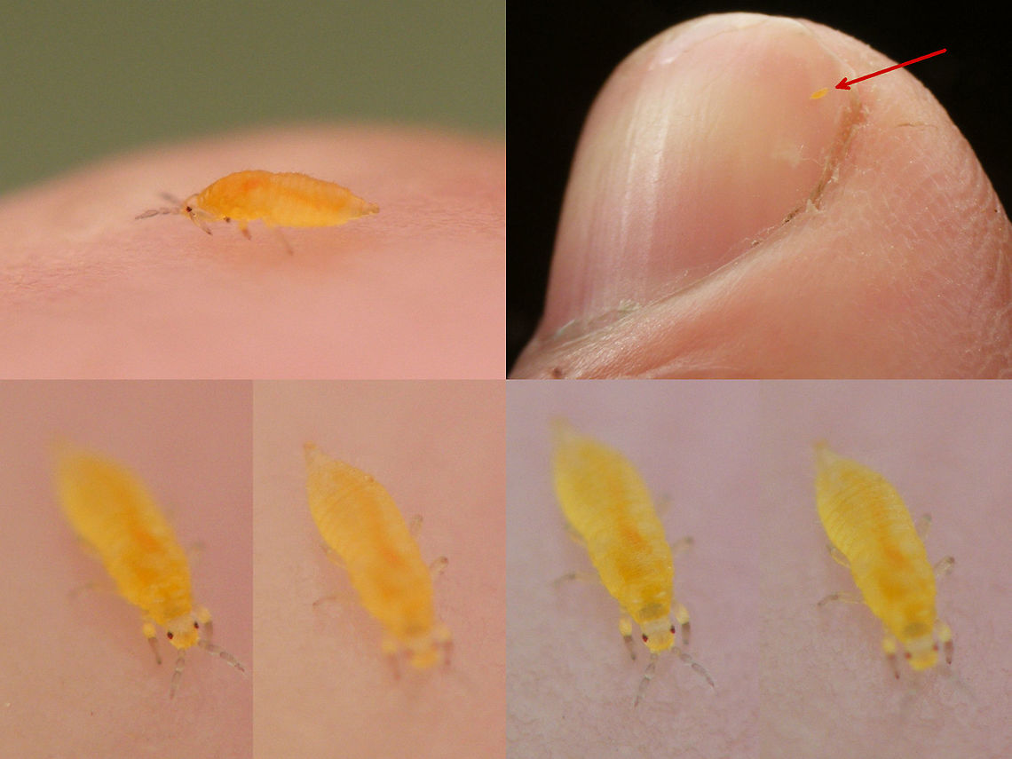 Unk. Thysanoptera nymph Collage Nymph of some "Thrips" (Thysanoptera), mostly for size. This stuff is really too small for my camera ... collage with various bits and pieces in and out of focus *rolleyes* <br />
<br />
 Netherlands,Thysanoptera