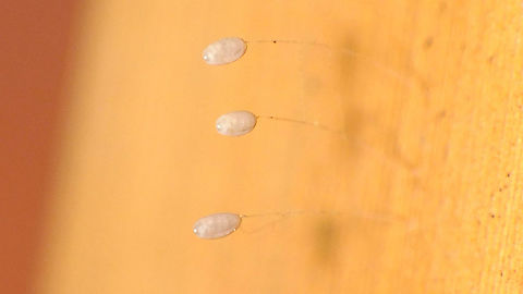 Pseudomallada (cf. fortunata) - Eggs, a day before hatching Sloppy photo of the eggs that produces the larvae below a day later:
https://www.jungledragon.com/image/90096/pseudomallada_cf._fortunata_-_freshly_hatched_larvae.html Chrysopidae,Eggs,Geotagged,La Palma (Canary Islands),Pseudomallada,Pseudomallada fortunata,Spain