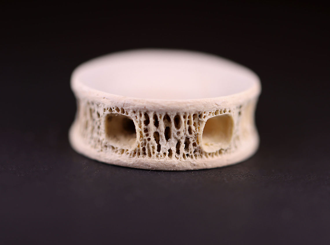 Common Thresher Shark (Alopias vulpinus) - Cartilaginous Vertebral Centra Here are a couple links to help visualize where this bone is located in the shark:<br />
<a href="https://jeb.biologists.org/content/jexbio/210/19/3319/F1.large.jpg" rel="nofollow">https://jeb.biologists.org/content/jexbio/210/19/3319/F1.large.jpg</a><br />
<a href="https://www.flickr.com/photos/mollivan_jon/8026038814" rel="nofollow">https://www.flickr.com/photos/mollivan_jon/8026038814</a><br />
<br />
**I have a fairly large collection of natural curiosities and decided to share some on JungleDragon. I have been collecting bits of nature for years and also have many friends who have shared things with me. Everything in my collection was ethically collected/harvested/sourced and is cruelty-free. Alopias,Alopias vulpinus,Geotagged,United States,Winter,common thresher shark,shark vertebra,vertebra,vertebral centra