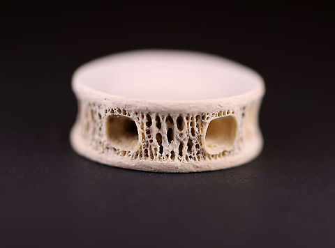 Common Thresher Shark (Alopias vulpinus) - Cartilaginous Vertebral Centra Here are a couple links to help visualize where this bone is located in the shark:
https://jeb.biologists.org/content/jexbio/210/19/3319/F1.large.jpg
https://www.flickr.com/photos/mollivan_jon/8026038814

**I have a fairly large collection of natural curiosities and decided to share some on JungleDragon. I have been collecting bits of nature for years and also have many friends who have shared things with me. Everything in my collection was ethically collected/harvested/sourced and is cruelty-free. Alopias,Alopias vulpinus,Geotagged,United States,Winter,common thresher shark,shark vertebra,vertebra,vertebral centra