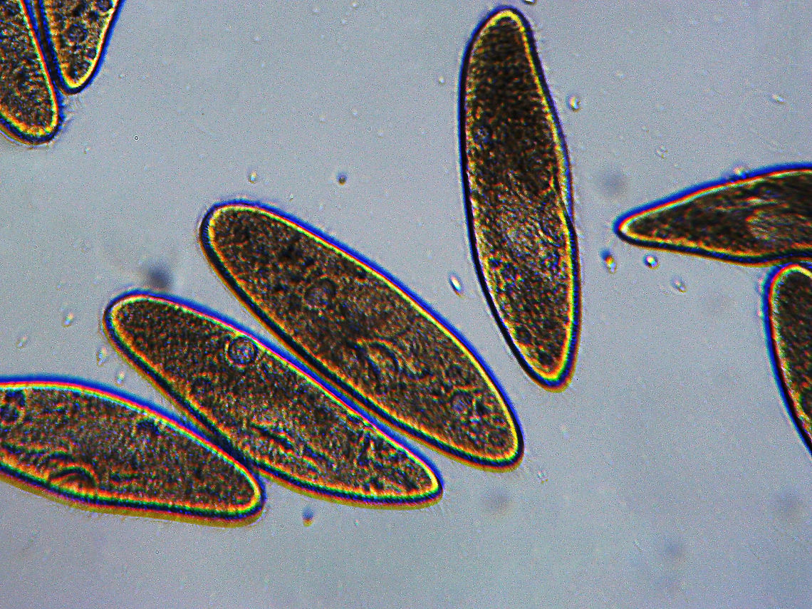 Paramecium multimicronucleatum Photo taken at 400x magnification.<br />
<br />
Paramecia are widespread in freshwater.  The move very quickly via cilia.<br />
<br />
<section class="video"><iframe width="448" height="252" src="https://player.vimeo.com/video/522577164?title=0&byline=0&portrait=0" frameborder="0"></iframe></section> Geotagged,Paramecium,Paramecium multimicronucleatum,United States,Winter,protist